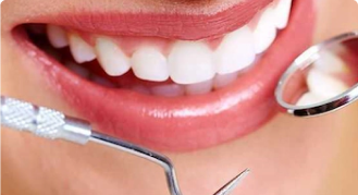 How much do dental implants cost in USA?